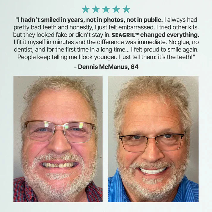 Ends Today: 79% OFF! SEAGRIL™ Custom-Fit Full Functional Dentures Make you more confident