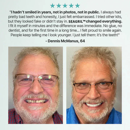 Ends Today: 79% OFF! SEAGRIL™ Custom-Fit Full Functional Dentures Make you more confident