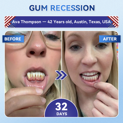 🦷𝐆𝐥𝐢𝐦𝐦𝐞𝐫𝐥𝐲® 𝐓𝐢𝐝𝐞𝐠𝐥𝐮𝐬𝐢𝐛 𝐓𝐨𝐨𝐭𝐡 & 𝐆𝐮𝐦 𝐑𝐞𝐩𝐚𝐢𝐫 𝐌𝐢𝐜𝐫𝐨𝐧𝐞𝐞𝐝𝐥𝐞 𝐏𝐚𝐭𝐜𝐡  | 𝐀𝐝𝐯𝐚𝐧𝐜𝐞𝐝 𝐒𝐭𝐞𝐦-𝐂𝐞𝐥𝐥 𝐀𝐜𝐭𝐢𝐯𝐚𝐭𝐢𝐨𝐧 𝐓𝐞𝐞𝐭𝐡 𝐒𝐭𝐫𝐢𝐩𝐬(🦷𝐑𝐞𝐛𝐮𝐢𝐥𝐝 𝐄𝐧𝐚𝐦𝐞𝐥 & 𝐃𝐞𝐧𝐭𝐢𝐧 • 𝐒𝐭𝐫𝐞𝐧𝐠𝐭𝐡𝐞𝐧 𝐆𝐮𝐦𝐬 • 𝐄𝐫𝐚𝐝𝐢𝐜𝐚𝐭𝐞 𝐓𝐚𝐫𝐭𝐚𝐫 & 𝐎𝐝𝐨𝐫 • 𝐒𝐭𝐨𝐩 𝐓𝐨𝐨𝐭𝐡 𝐒𝐞𝐧𝐬𝐢𝐭𝐢𝐯𝐢𝐭𝐲)